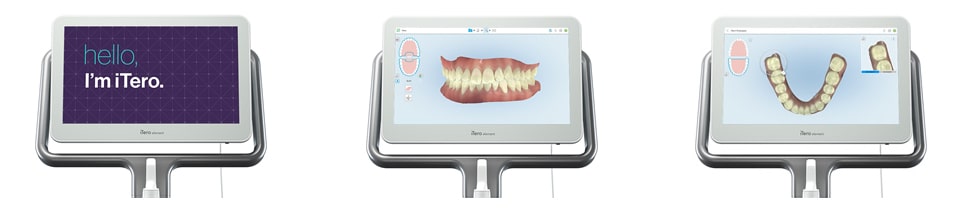 iTero Element（アイテロエレメント）
