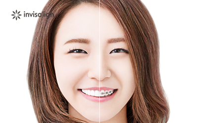 トラブルが少ない